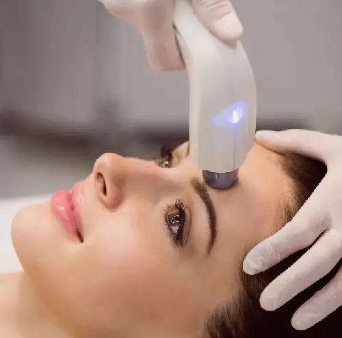 Laser hair reduction treatment